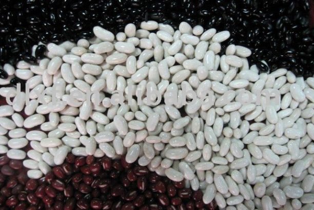 best spots where you can purchase black and white beans